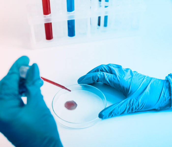 Análisis Bioquímico